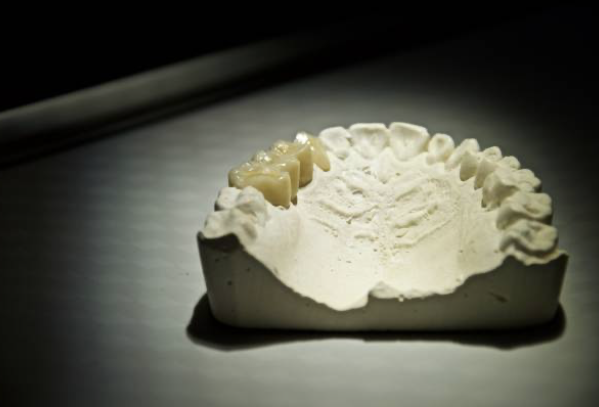 PMMA-Dental-Lab