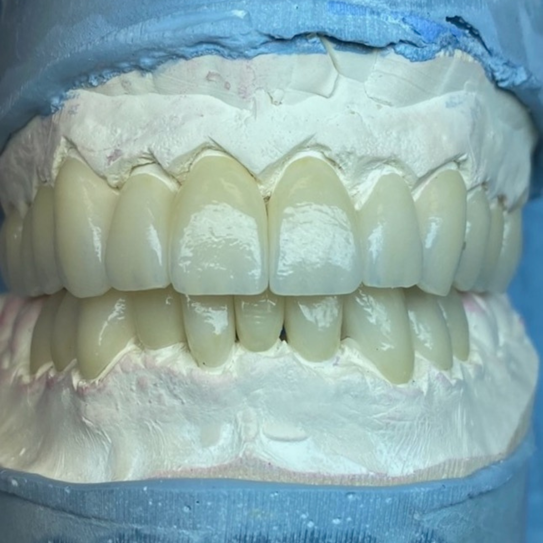 los-angeles-dental-lab