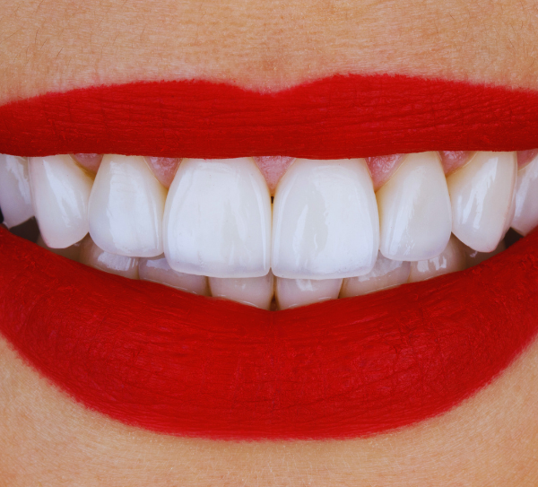 porcelain-veneer-fabrication